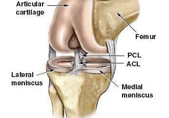 acl
